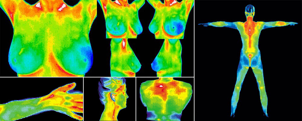 Thermography Scans  Winchester, VA 